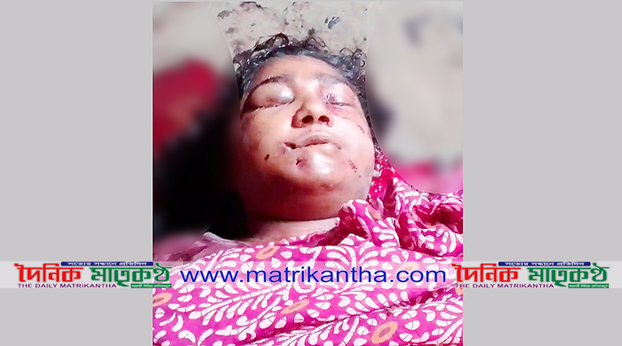 কালুখালীর মাঝবাড়ীতে ইট দিয়ে আঘাত করে স্ত্রী’কে হত্যার পর স্বামী পলাতক